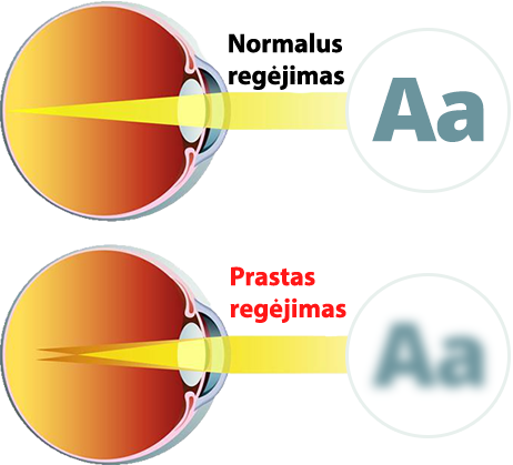 Alt