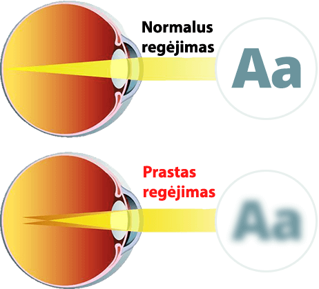 Alt